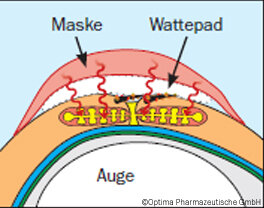 Lipo Nit The Eye Doctor Augen-Wrme-Maske (optima)